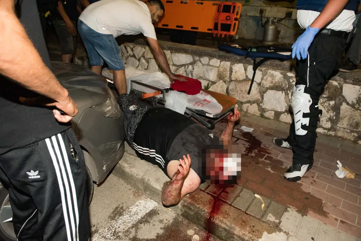 פצוע בפרעות בעכו במהלך מבצע שומר החומות