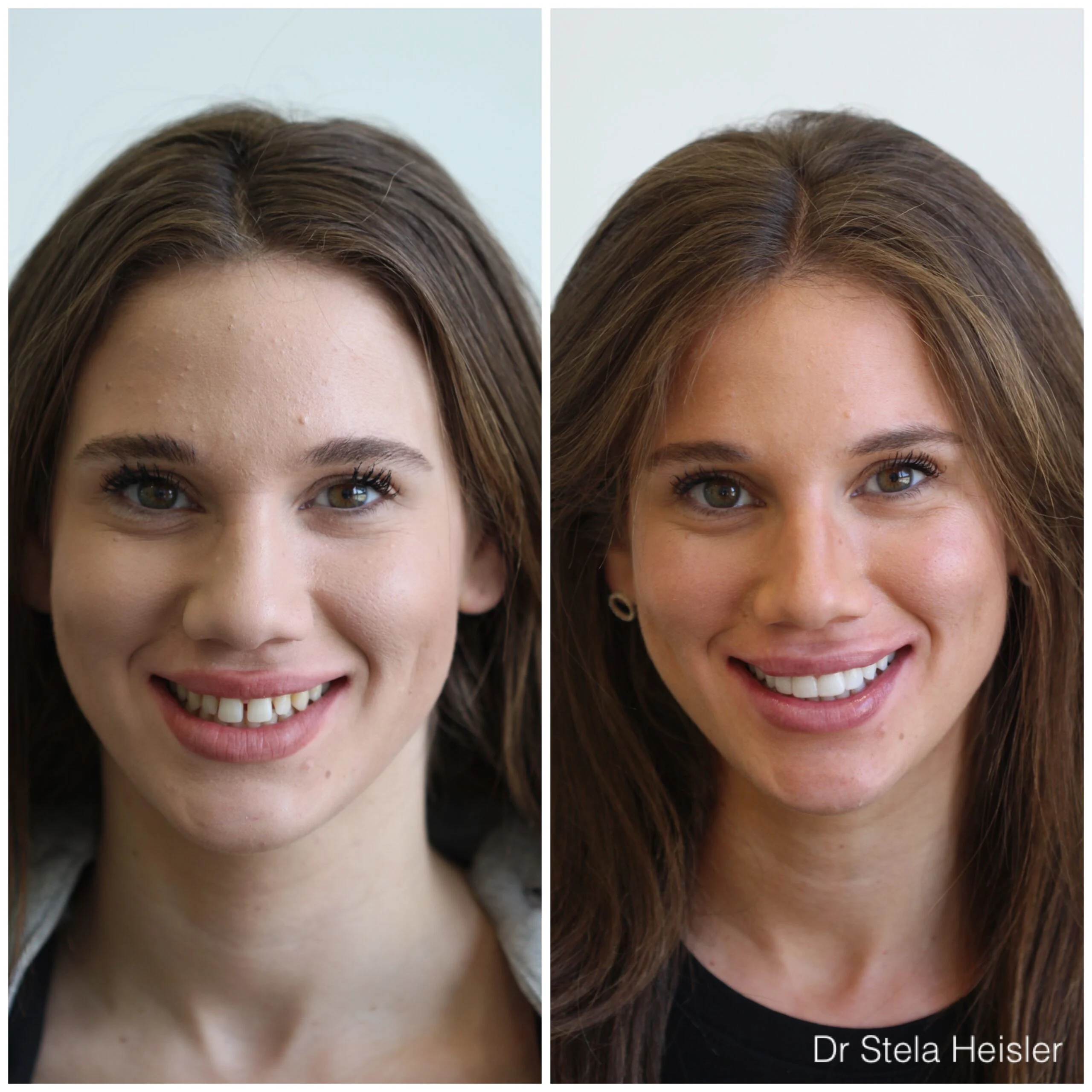 ד''ר סטלה הייזלר