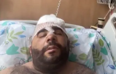 מור ג'נשווילי, שנפגע בלינץ' בעכו בשומר חומות, בשיחה עם חדשות 13