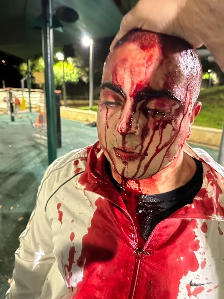 אורין בניאן, החייל שנפצע כשניסה להפריד בקטטה בין נערים