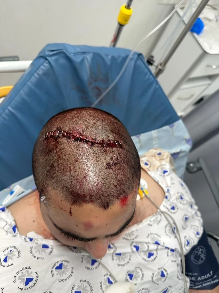 אורין בניאן, החייל שנפצע כשניסה להפריד בקטטה בין נערים