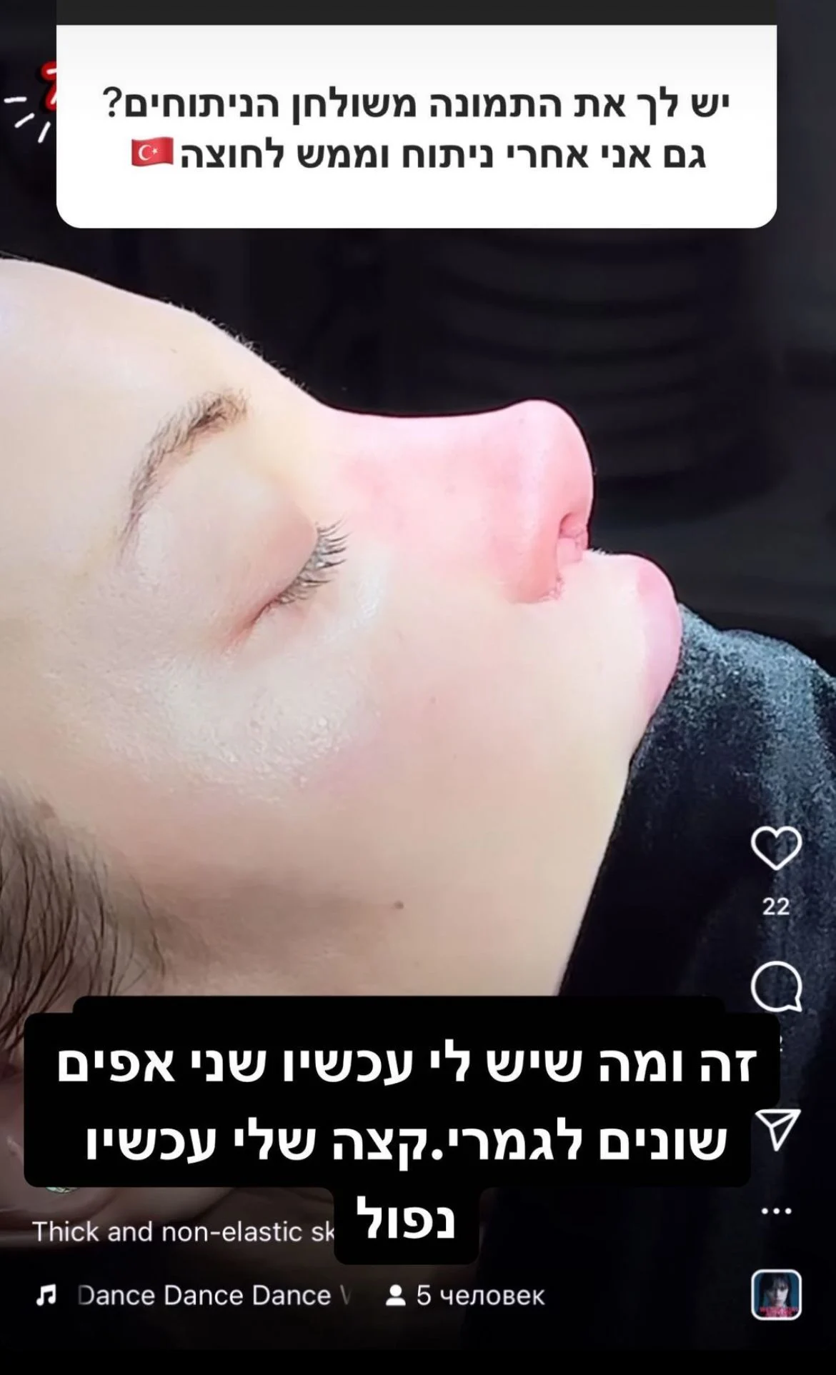 אלה אייבנדר אחרי הניתוח