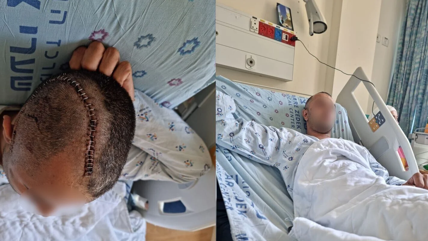 הצעיר הערבי שהותקף במוט ברזל ממניע גזעני