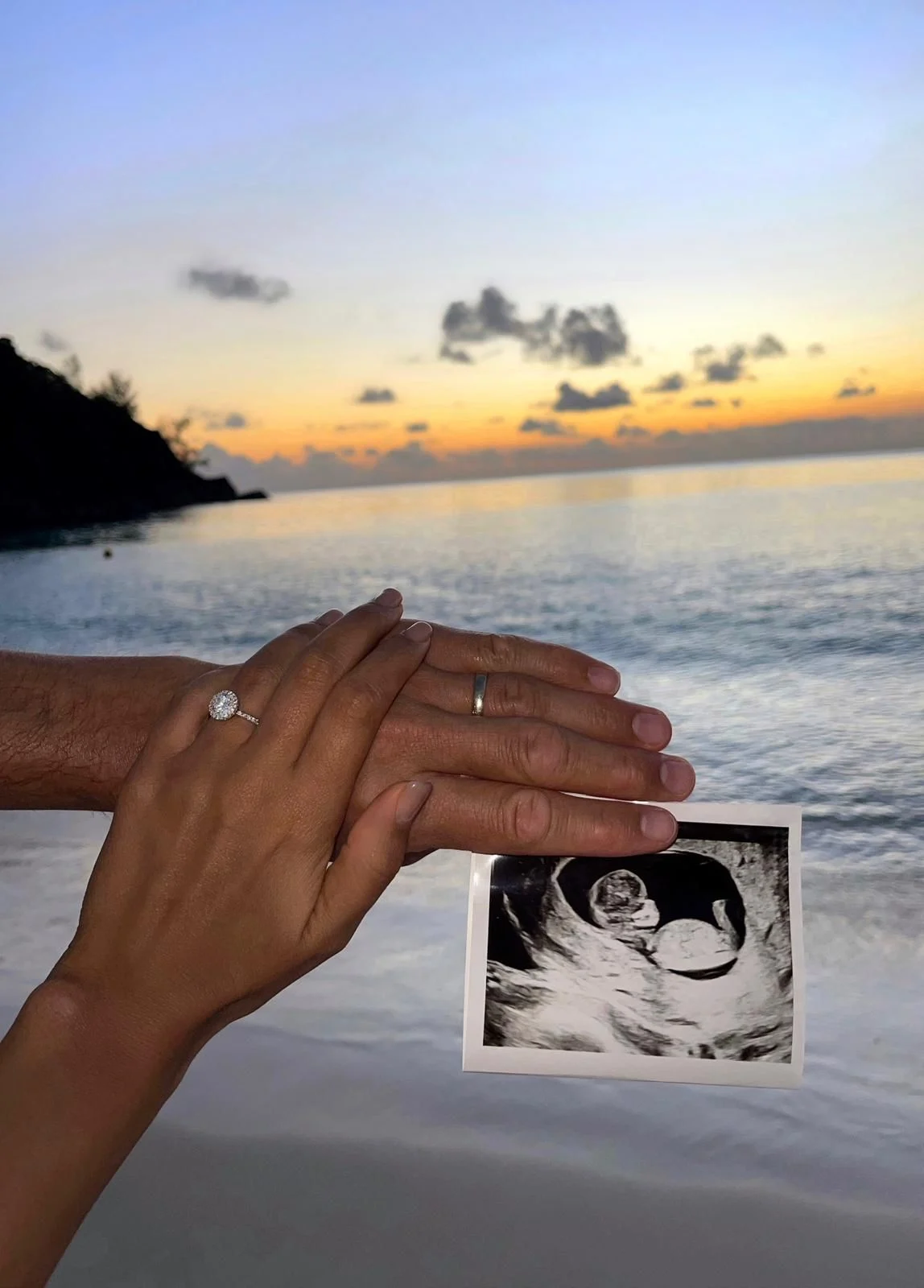 נטע אלחמיסטר