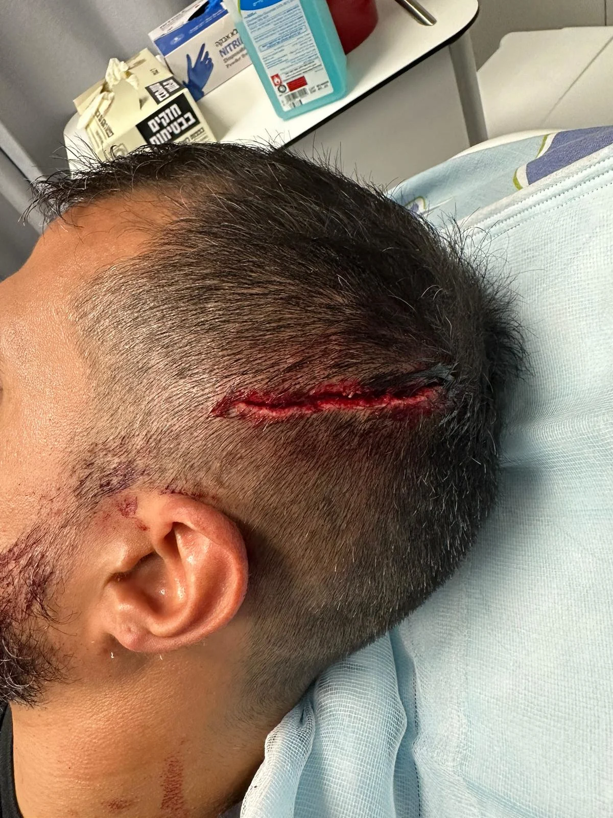 השוטר שנפגע מאבן